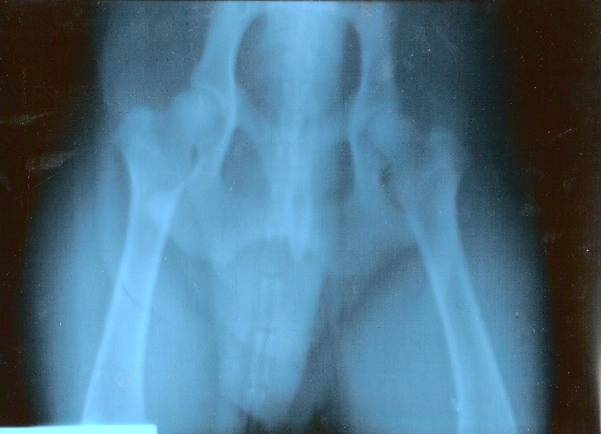 Josh_x-ray_1-18-08.jpg